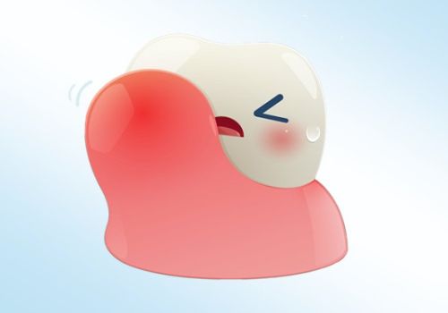 Viêm nha chu: Nguyên nhân, dấu hiệu và cách điều trị viêm nha chu